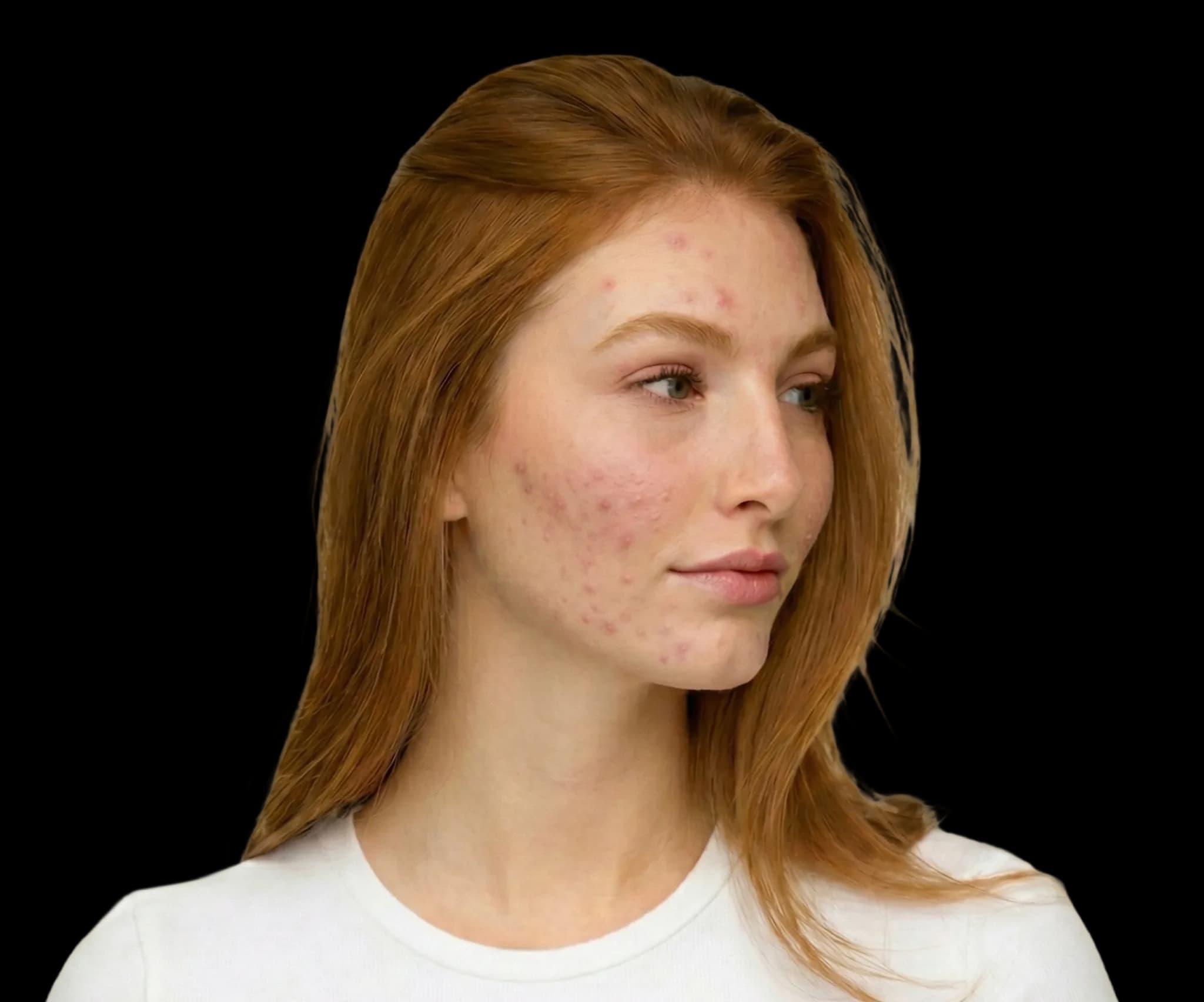 Hair after treatment